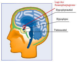 Hypophyse, Schema. Die Hypophyse ist eine
                          wichtige Hormondr�se f�r die
                          Geschlechtshormone, und wenn die mit
                          Quecksilber verschmutzt ist, so kann man sich
                          nur ausmalen, wie gesch�digt dann die Menschen
                          sind...