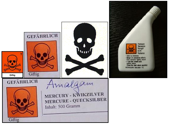 Amalgam mit Quecksilber - Totenkopf
                        bei Quecksilber