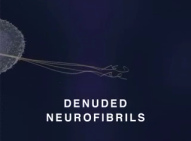 Film �ber
                                        Quecksilberwirkung an Nerven 09:
                                        Es bleiben nur noch nackte
                                        Nervenfasern (engl.:
                                        "denuded
                                        neurofibrils") �brig