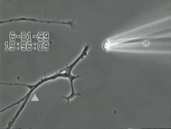 Nerven unter
                                        Quecksilbereinfluss (R�ntgenfoto
                                        01): Es wird Quecksilber
                                        gespritzt