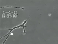 Nerven unter
                                        Quecksilbereinfluss (R�ntgenfoto
                                        02): Die R�ckbildung der Nerven
                                        beginnt