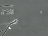 Nerven unter
                                        Quecksilbereinfluss (R�ntgenfoto
                                        03): Die Nerven bilden sich
                                        weiter zur�ck, es bleiben nur
                                        noch Nervenfasern