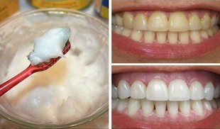 Coconut
                              oil+soda=toothpaste