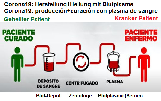 Heilung von Corona19
mit Blutplasma, Schema - curación de
Corona19 con plasma de sangre,
esquema Heilung von Corona19 mit
Blutplasma, Schema - curación de
Corona19 con plasma de sangre,
esquema