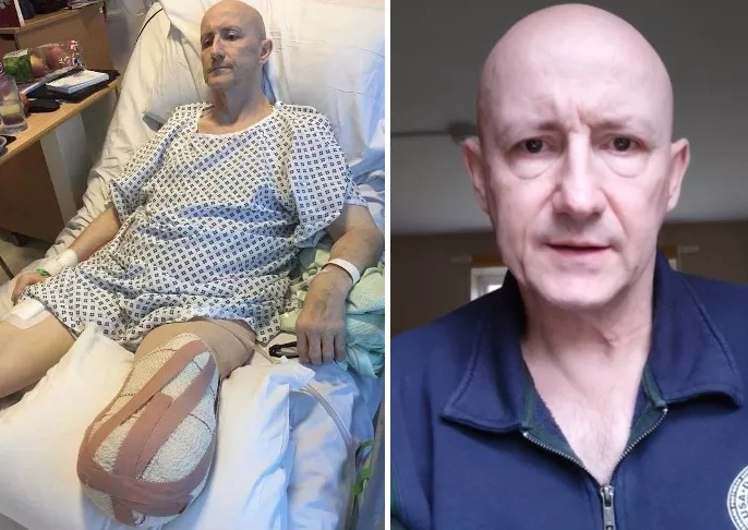 Dave Mears: Nach GENimpfung von AstraZeneca
Bein amputiert Dave Mears: Nach GENimpfung
von AstraZeneca Bein amputiert