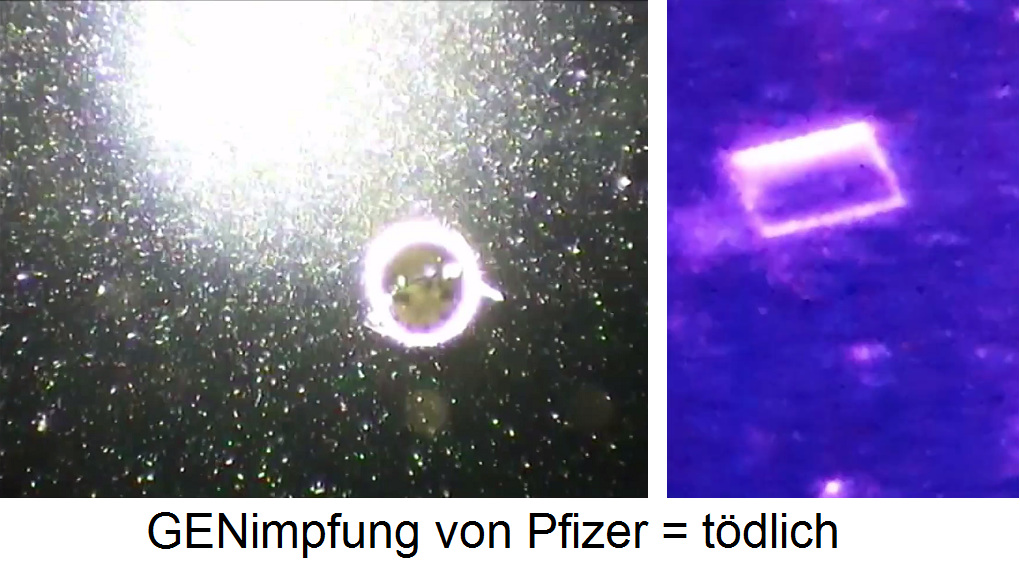 Pfizer-GENimpfstoff unter dem
Dunkelfeldmikroskop mit Blasen,
Schläuchen und rechteckigen
Nanoteilchen Pfizer-GENimpfstoff
unter dem Dunkelfeldmikroskop mit
Blasen, Schläuchen und rechteckigen
Nanoteilchen