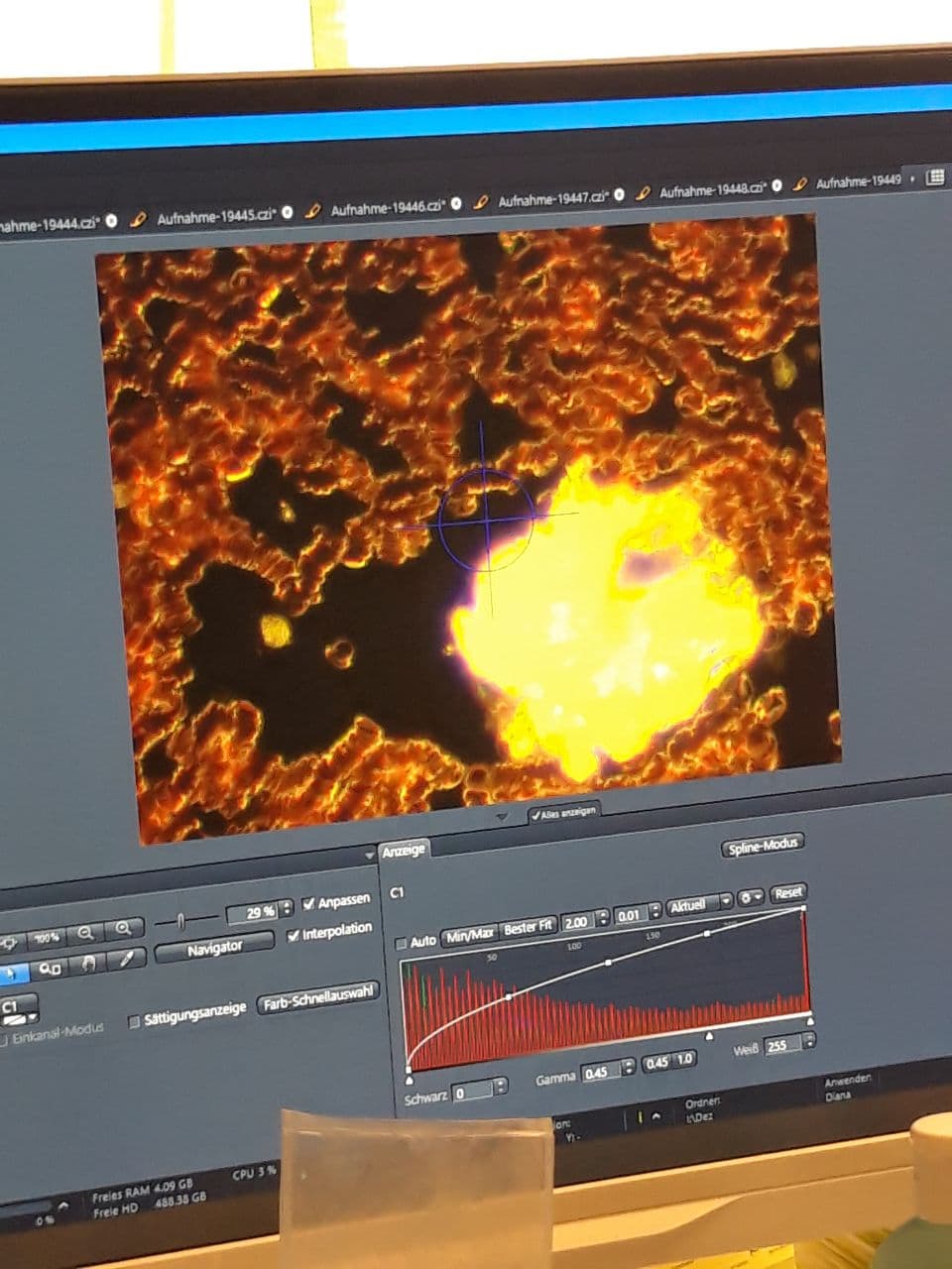 Shedding am 17.2.2022: Shedding tagelang im
Klassenzimmer macht das Blut kaputt Shedding am
17.2.2022: Shedding tagelang im Klassenzimmer macht
das Blut kaputt