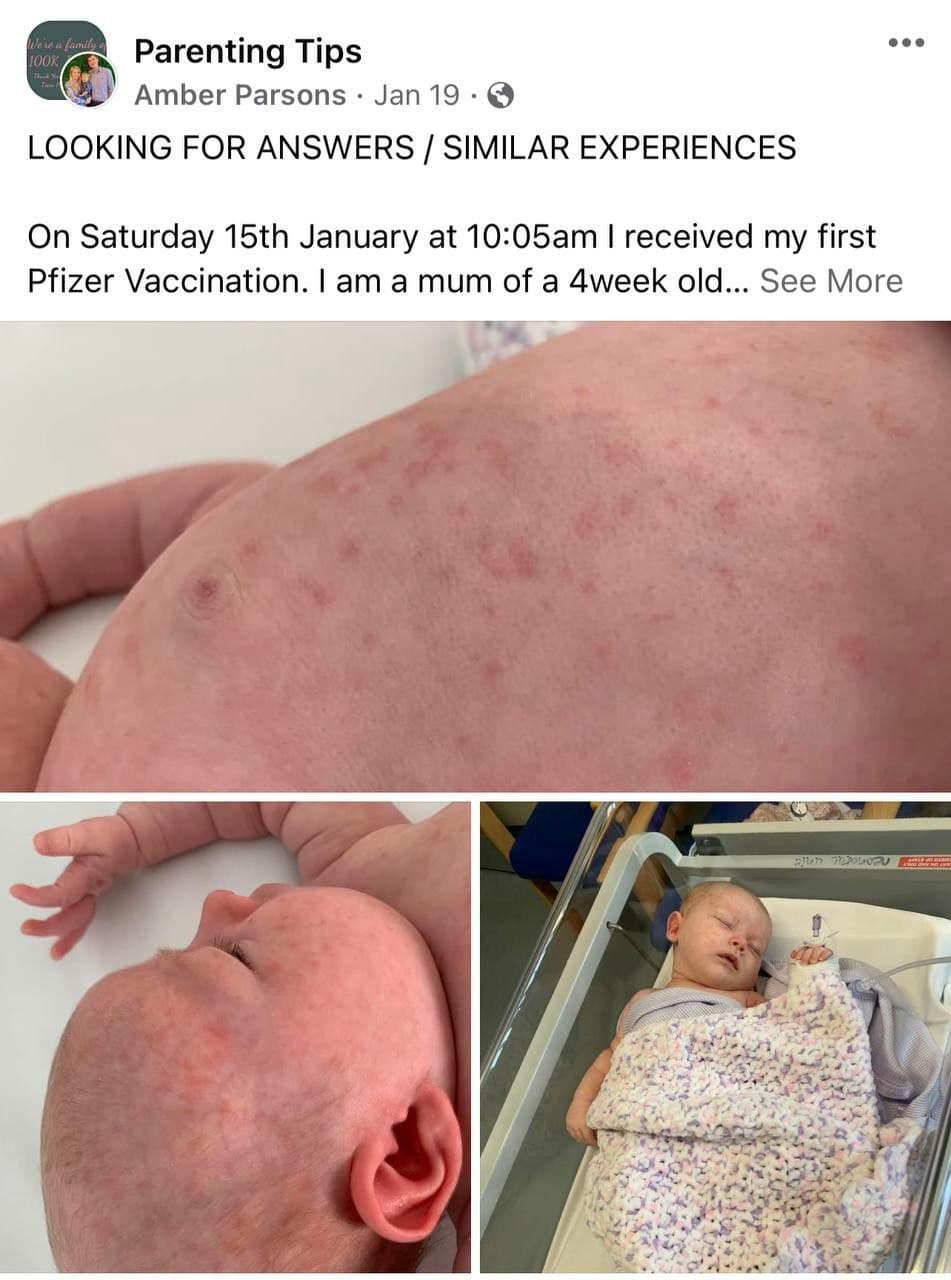 Stillende Mutter l�sst sich GENimpfen
                    21.2.2022: Baby bekommt Kotzen+Ausschlag El 15 de
                    enero, mam� recibi� su primera dosis de Pfizer. Ella
                    est� amamantando. Esa noche, su hija de 4 semanas se
                    enferm� gravemente y vomitaba cada vez que
                    amamantaba. Entonces apareci� la erupci�n