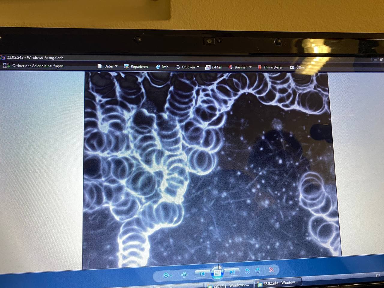 GENimpfschaden Schweiz 28.2.2022: Blutschaden
- alle roten Blutkörperchen sind gestapelt GENimpfschaden Schweiz 28.2.2022: Blutschaden -
alle roten Blutkörperchen sind gestapelt