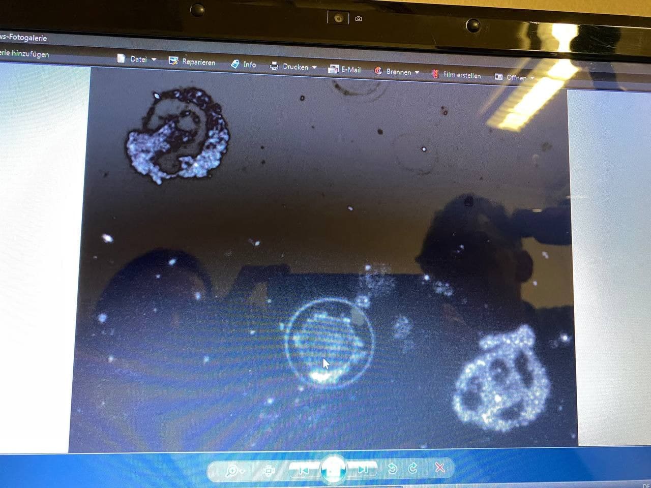 GENimpfschaden Schweiz 28.2.2022: Blutschaden
bei 3x GENimpfung: Bakterien im Blut GENimpfschaden Schweiz 28.2.2022: Blutschaden
bei 3x GENimpfung: Bakterien im Blut