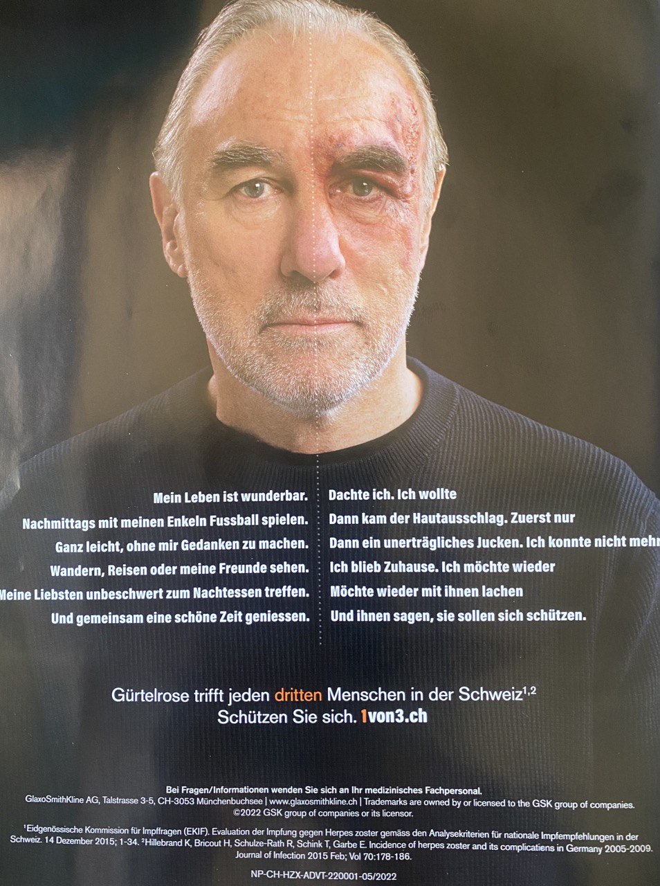 SCHLANGENGIFTimpfschaden Schweiz 15.7.2022:
Gürtelrose im Gesicht SCHLANGENGIFTimpfschaden
Schweiz 15.7.2022: Gürtelrose im Gesicht