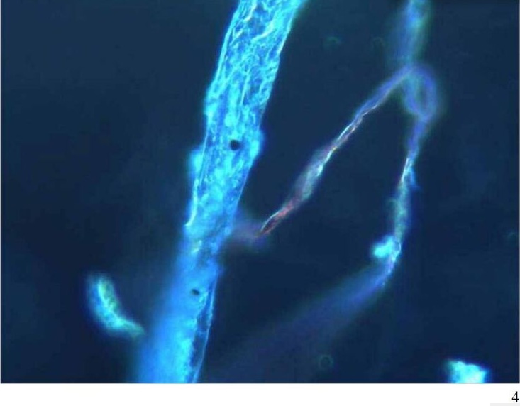 Mann mit
                    Pfizer hat Blutschaden: eine selbstaggregierende
                    Strukturierung