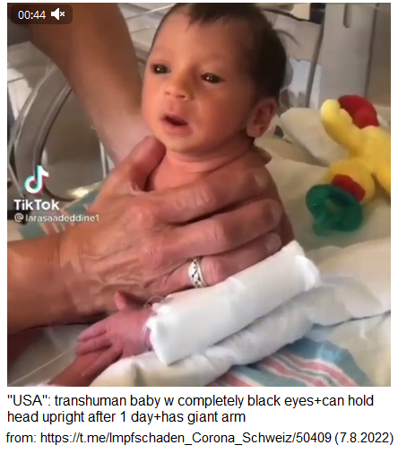 Transhuman baby from
                    "Corona" vaxxed parents have totally black
                    eyes and are opened after 1 day already + can hold
                    it's head upright after 1 day already + has a giant
                    arm + and has adult facial features