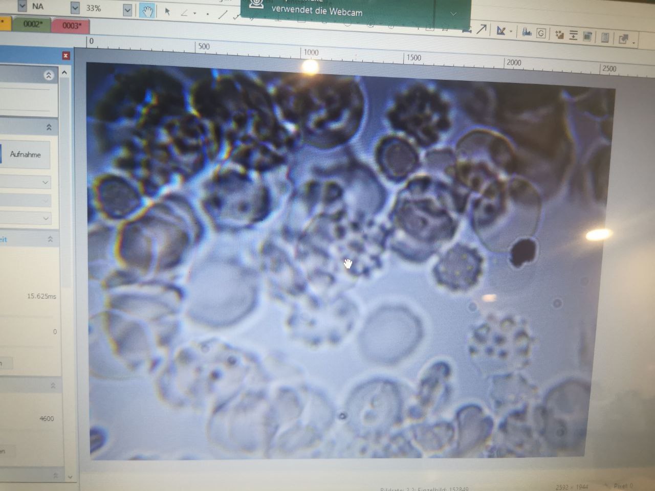 7.12.2022: krankes, geimpftes Blut 100x
vergrössert 7.12.2022: krankes, geimpftes Blut
100x vergrössert