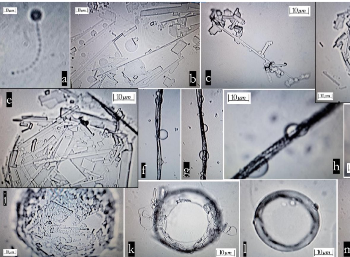 Inhaltsstoffe der "Coronaimpfungen"
von Pfizer+Moderna am 16.8.2024: Es bilden sich im
Körper animierte Fasern Inhaltsstoffe der
"Coronaimpfungen" von Pfizer+Moderna am
16.8.2024: Es bilden sich im Körper animierte Fasern