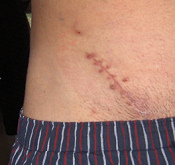 y para una curaci�n
                      buena de heridas la alimentaci�n seg�n el grupo
                      sangu�neo es decisiva tambi�n