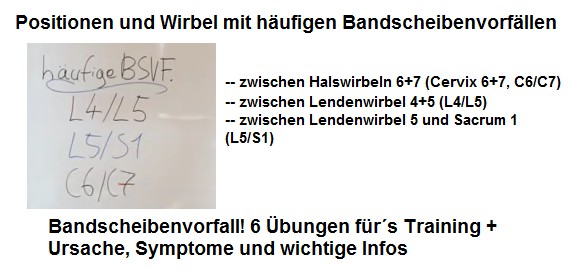 Die Positionen
                              und Wirbel mit den h�ufigsten
                              Bandscheibenvorf�llen