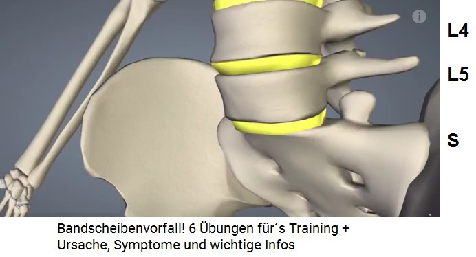 Lendenwirbel L4 und L5 sowie das
                              Sacrum, Schema