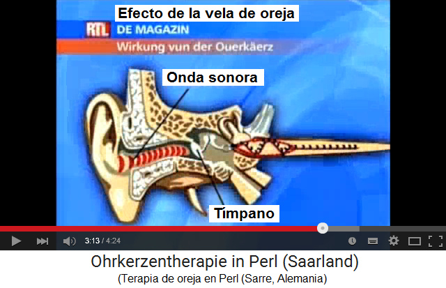 Vela de oreja, el efecto
con el tímpano y la onda sonora Vela de oreja, el efecto con el
tímpano y la onda sonora
