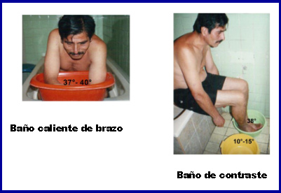 Luyando Joo: baño caliente de
brazos y de pies Luyando Joo: baño caliente de
brazos y de pies