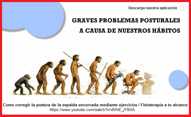 La evoluci�n a la cifosis de computadora -
                    esquema