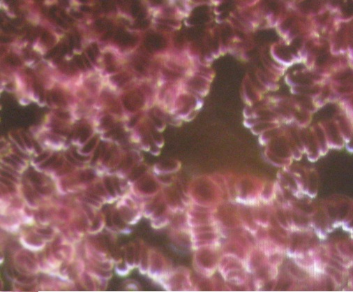 Blut
                  gestapelt 600fach vergr�ssert