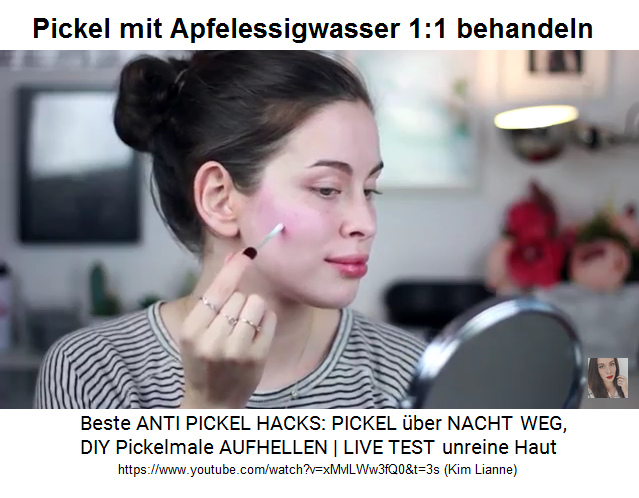 Pickel mit Apfelessigwasser im
                Verh�ltnis 1:1 behandeln