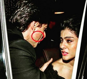 Pintalabios en mejilla