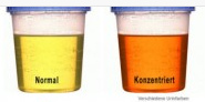 Urin normal hellgelb und konzentriert
                      dunkelgelb