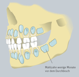 �ber den Milchz�hnen warten die
                              Erwachsenenz�hne, bzw. die
                              Erwachsenenz�hne vertreiben in der
                              Kindheit und Jugend die Milchz�hne.