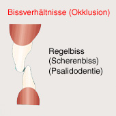 Schneidez�hne im "Scherenbiss",
                    Schema