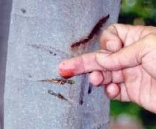 Oncolog�a: c�ncer cuara p.e. con
                              sangre de grado