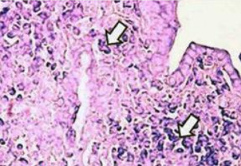 Microfotografía
de pulmón de rata intoxicada por antracenonas
de una planta silvestre. Microfotografía de
pulmón de rata intoxicada por antracenonas de
una planta silvestre.