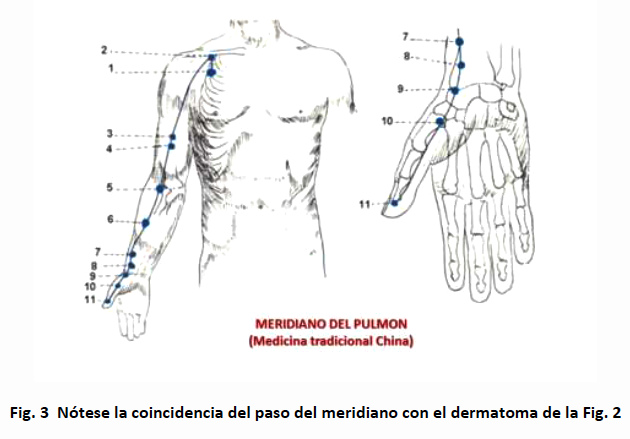 Meridiano del pulmón Meridiano del pulmón