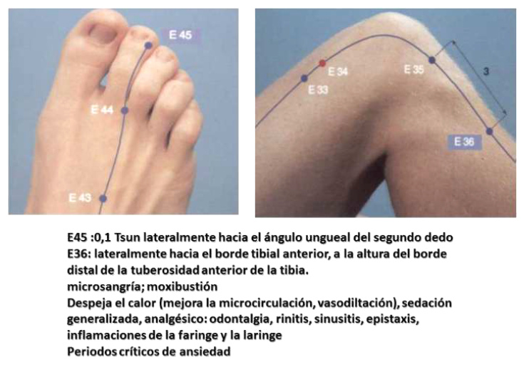 Puntos de dolores E45 y E36