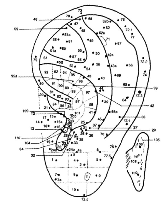 Cartograma auricular Cartograma auricular