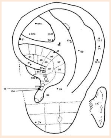 Cartograma auricular, enfasis
en el centro Cartograma auricular, enfasis en el
centro