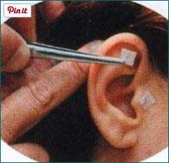 curita de
              semilla es fijado con pinzas en la oreja