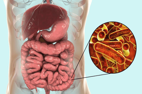 dysentery infection, diagram with stomach,
intestines and pathogens dysentery infection,
diagram with stomach, intestines and pathogens