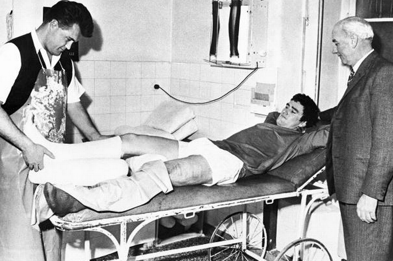 Smashed leg from accident, Jim Baxter Smashed leg from accident, Jim Baxter