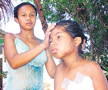 Heridas en todo el cuerpo por 4 perros
                        guardi�n [18]