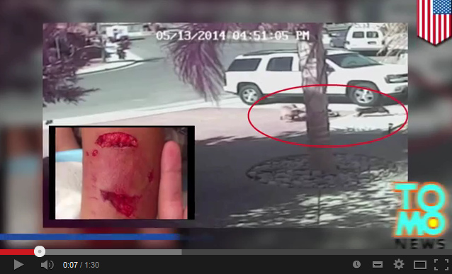 Tiefe Bisswunden durch den
                            Hundeangriff des grossen Labradors gegen den
                            4-j�hrigen Bub