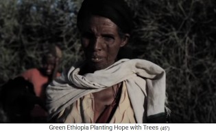 Mangelern�hrung in �thiopien