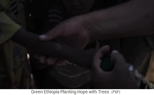 Ein Bub hat eine Verbrennung am Unterarm