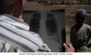 Kurt Pfister kontrolliert ein
                      R�ntgenfoto einer Lunge