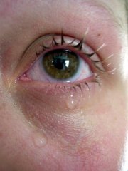 Auge mit Tr�nen
