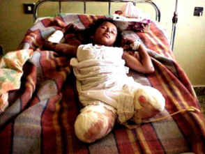 Minenopfer: M�dchen ohne Beine [1] - und den
              Minenproduzenten und den Kriegsproduzenten ist das einfach
              egal...