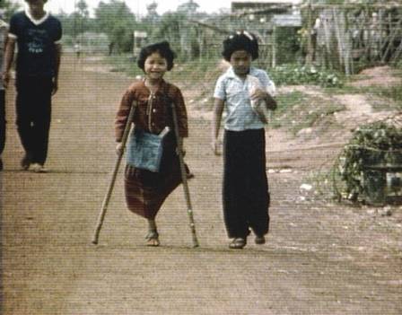Minenopfer: Mädchen mit nur einem Bein in Asien
(Region Kambodscha, Burma und Laos) Minenopfer: Mädchen mit nur einem
Bein in Asien (Region Kambodscha, Burma und Laos)