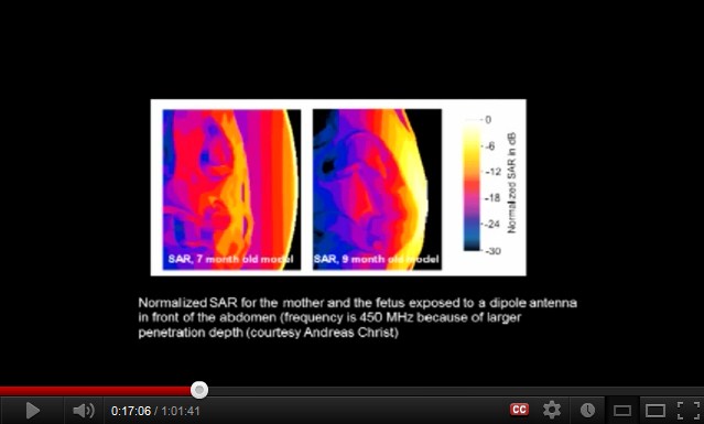 Ein Handy an
              einem Bauch einer schwangeren Frau verstrahlt den F�tus