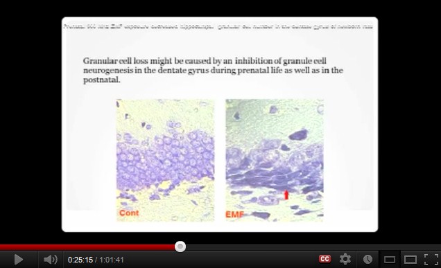 Die Zellkerne sind nach der Exposition mit 900
MHz nicht mehr da Die
Zellkerne sind nach der Exposition mit 900 MHz nicht mehr
da